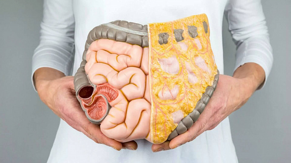 «Психосоматика заболеваний системы пищеварения» - Татьяна Рожкова