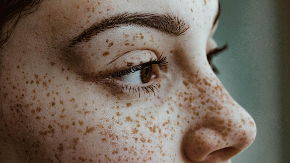 «Антипигментация» - Этель Аданье