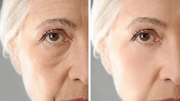 «Ключ к долголетию - бесконтактное омоложение» - Леа Виктория