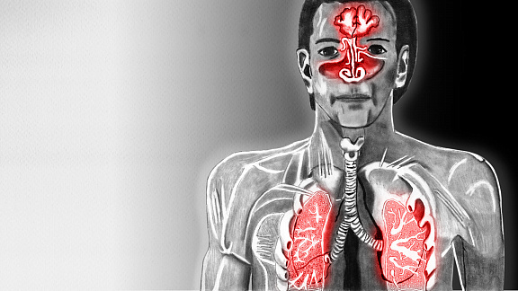 «Психосоматика заболеваний дыхательной системы-2» - Рожкова Татьяна