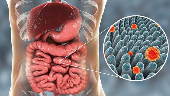 «5 главных шагов очищения от паразитов, бактерий, вирусов» - Сведовая Наташа